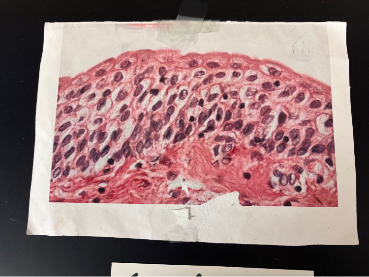 <p>What kind of blood/bone/tissue/cartilage is this?</p>