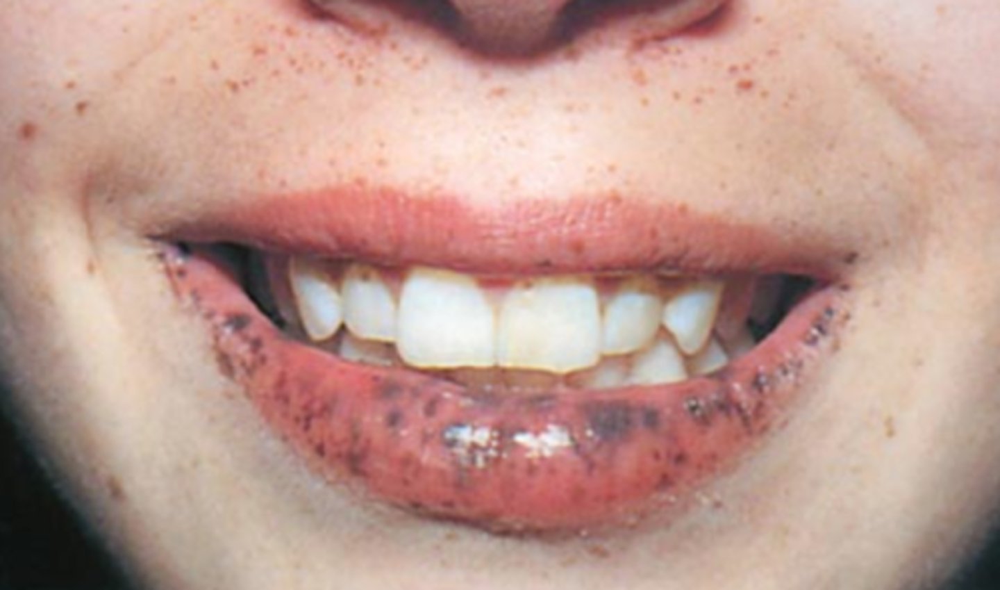 <p>What is the diagnosis?</p>