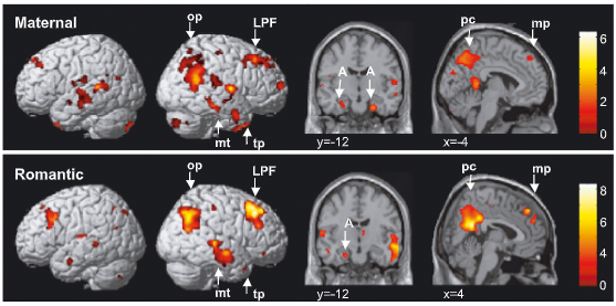<p>Amygdala, PCC, medial PFC, middle temporal cortex, temporal poles, occipitoparietal junction. </p>