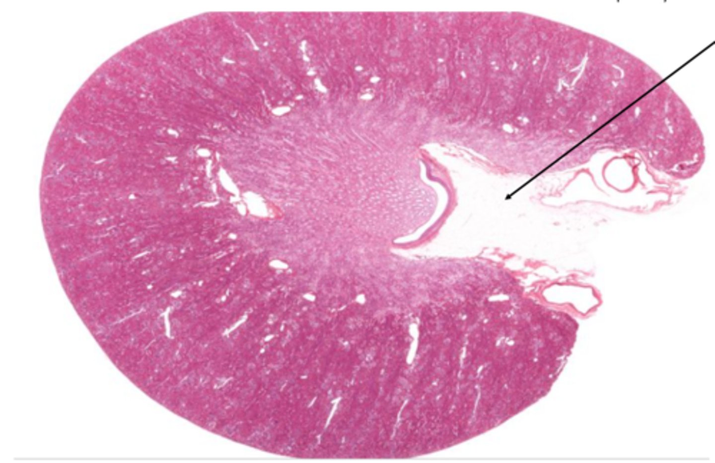 <p>Identify the structure on the kidney</p>