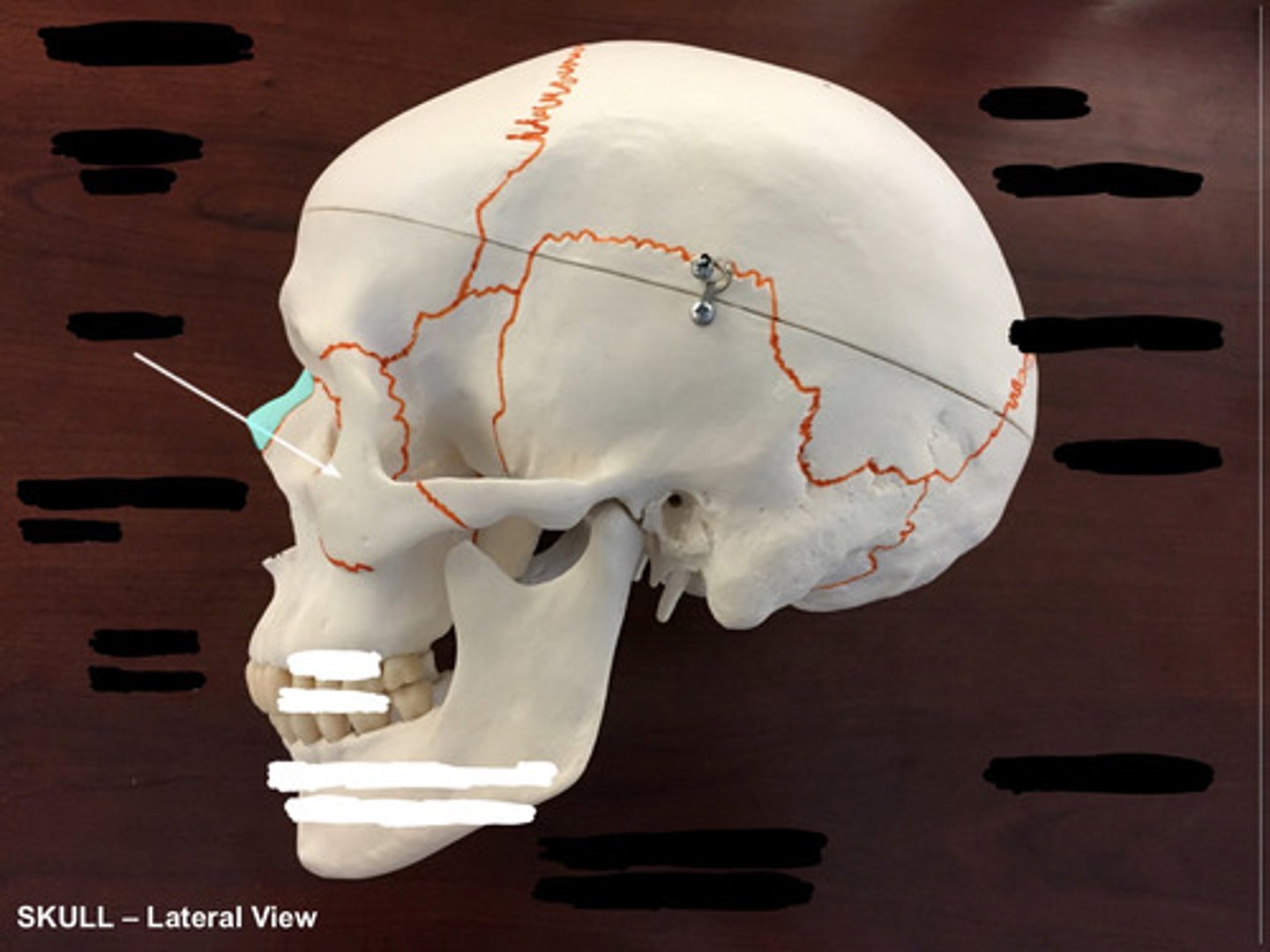 <p>What bone is highlighted here?</p>