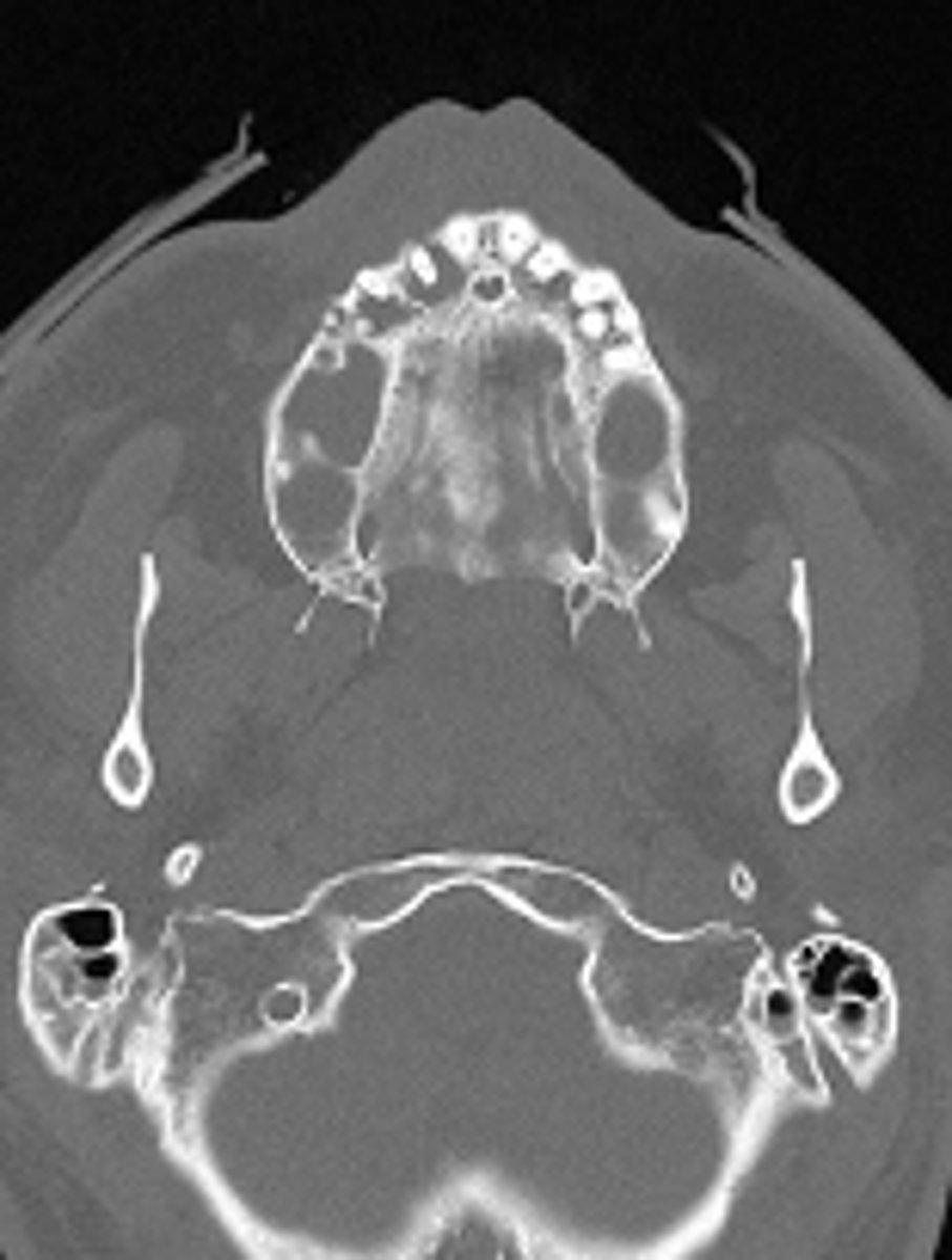 <p>ID the CT view:</p>