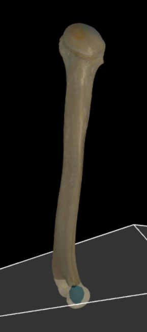 <p>Goed ontwikkelde knobbel aan de mediale zijde boven de condylus humeri.</p>