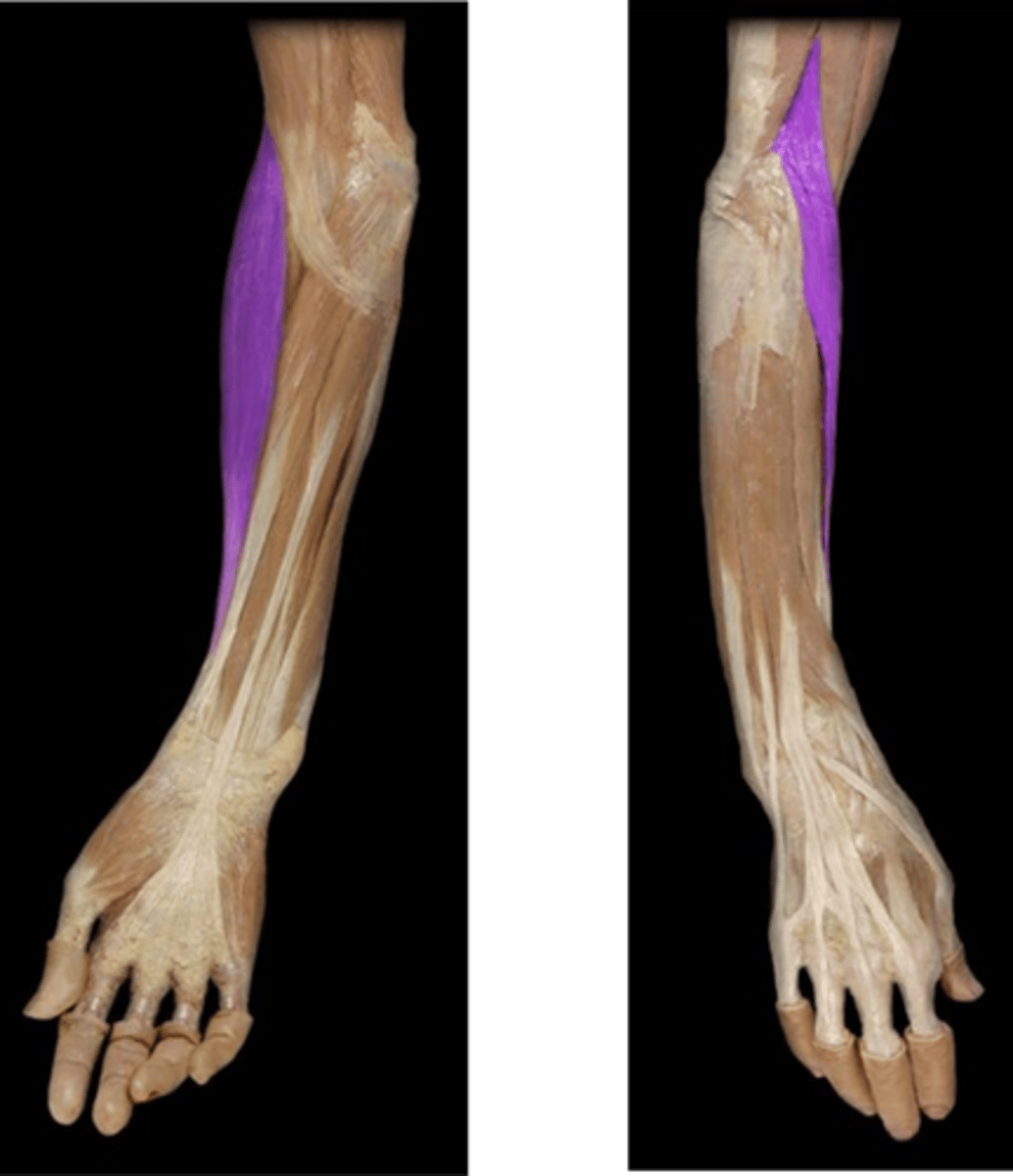 <p>-Flexes forearm</p><p>-Radial n. (C5 - T1)</p><p>-On anterolateral surface of forearm</p>