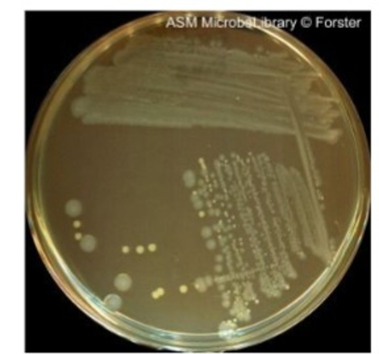 <p>A pure culture derived from one bacterial cell.</p>