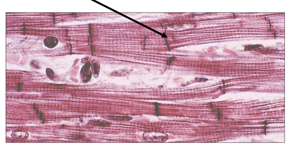 <p>The arrow is pointing to</p><p></p><p>a. Nucleus</p><p>b. Mitochondrion</p><p>c. T tubule</p><p>D. Intercalated disc</p>