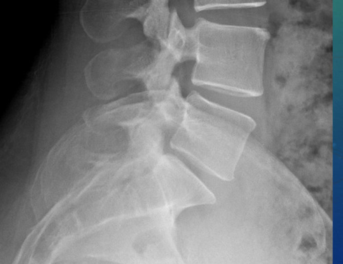 <p>What projection view is this?</p>