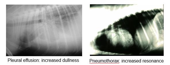 <ul><li><p><em>(percuss both sides of chest)</em></p></li><li><p>Identify any asymmetry / areas of increased / decreased percussion resonance</p></li><li><p>Pleural effusion —> increased dullness</p></li><li><p>Pneumothorax —> increased resonance</p></li></ul><p></p>