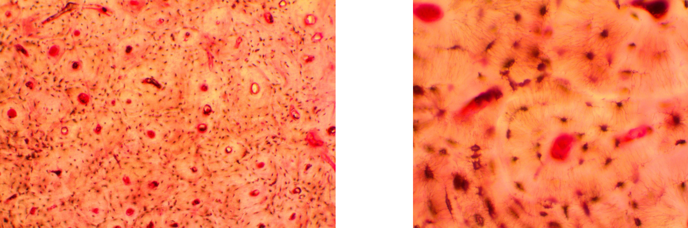 <p>Bone connective tissue (compact)</p>