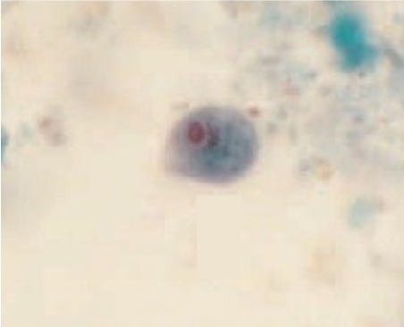 term image