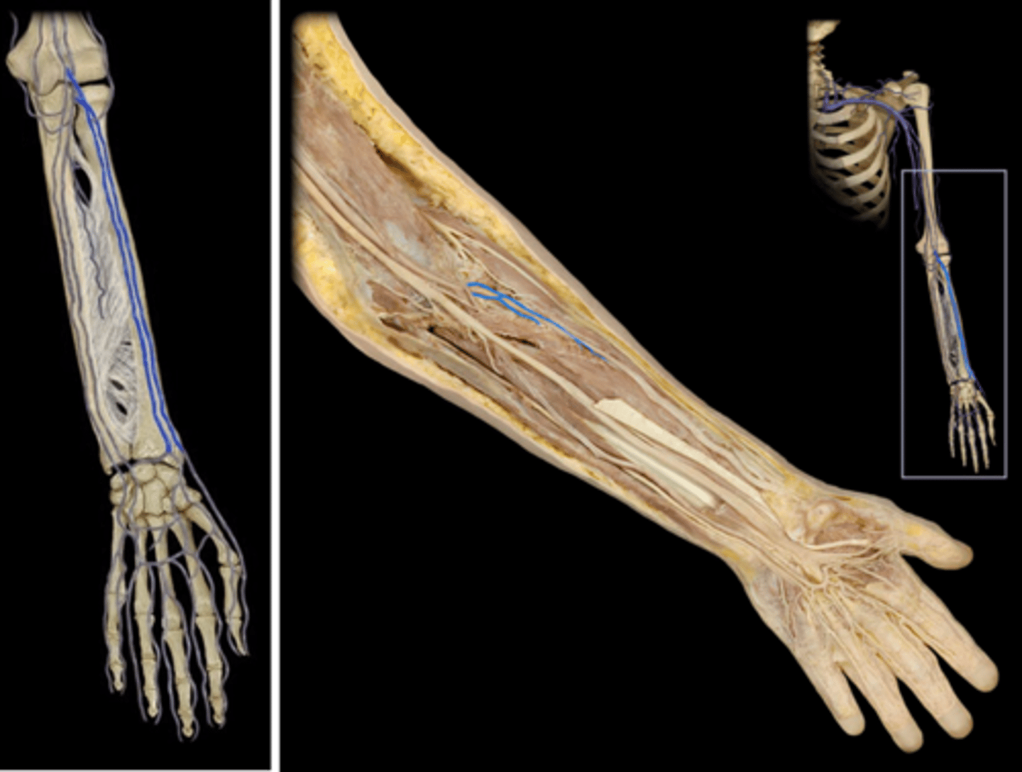 <p>Name this vessel.</p>