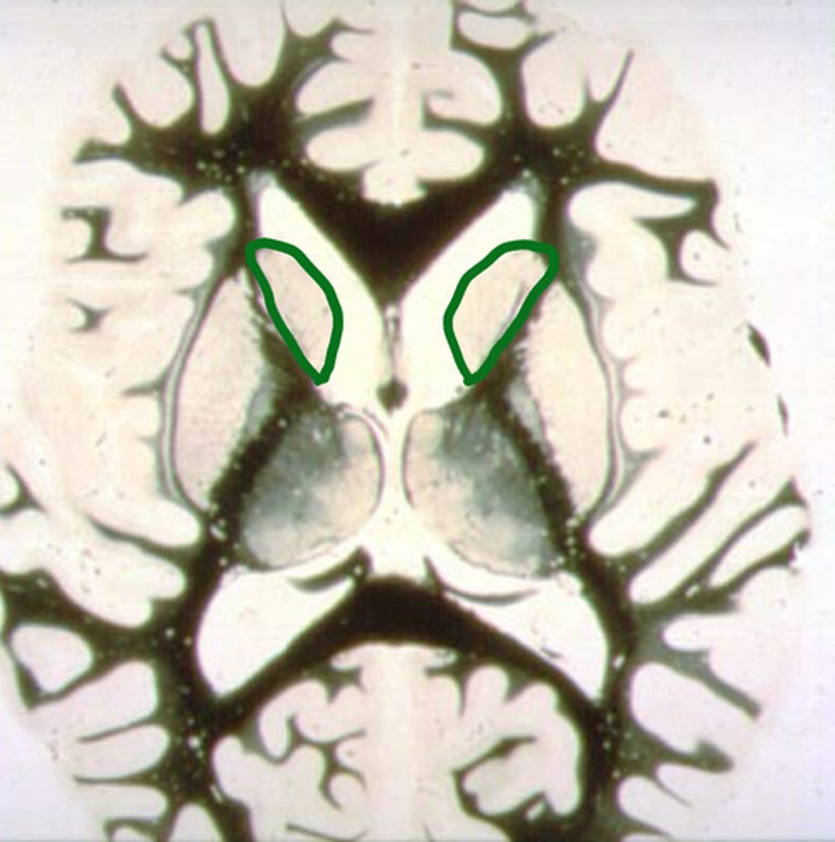 <p>identify the structure</p>