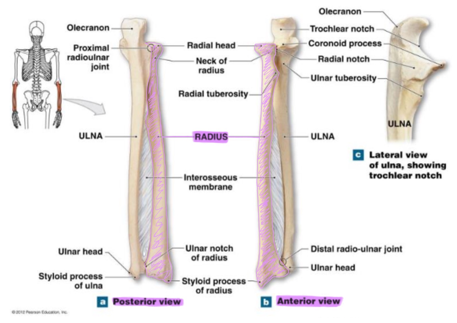 <p>works w/ ulna to allow rotation of forearm (supination/pronation)</p>