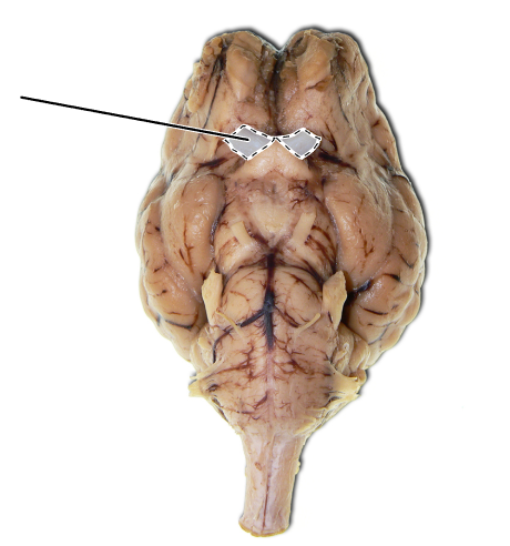 <p>Name the part of the brain that is highlighted.</p>