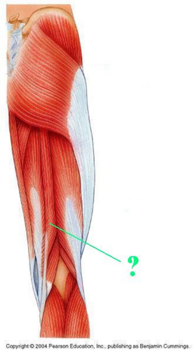 <p>Idenitfy the indicated muscle</p>