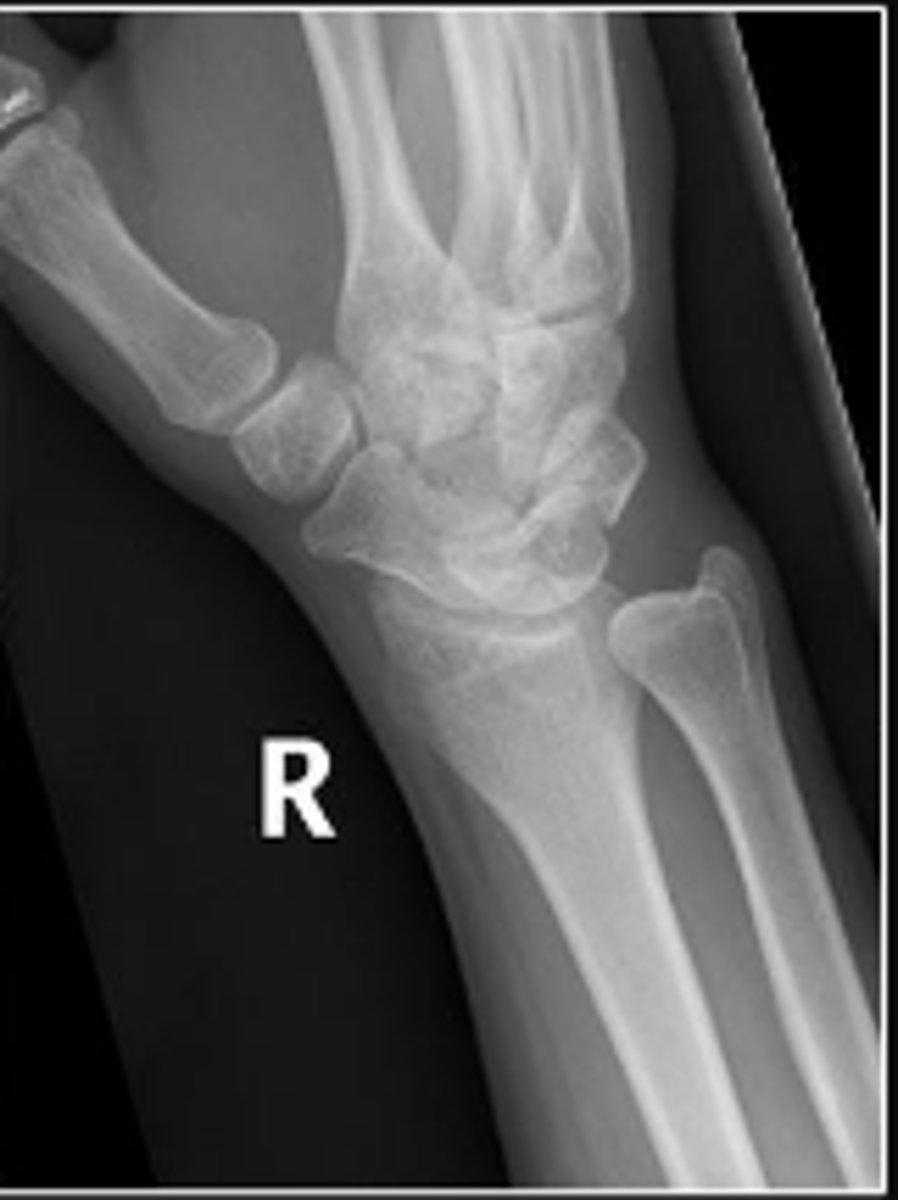 <p>What is the name of the radiographic view?</p>