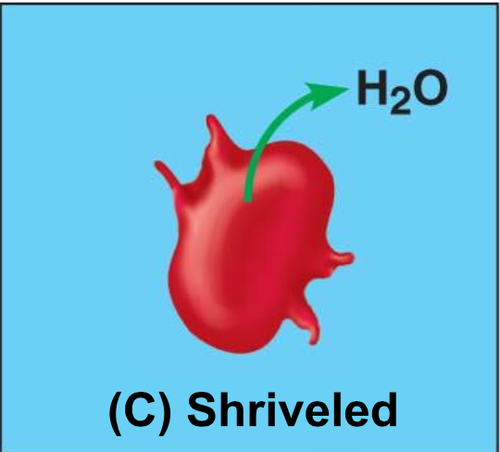 when the solute concentration is greater than that inside the cell; cell loses water
