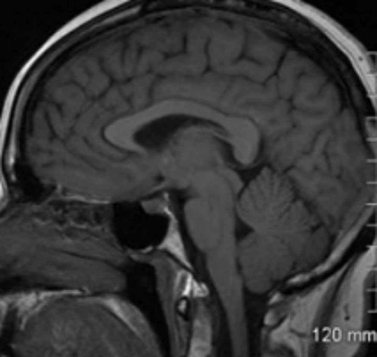 <p>imaging plane that is along the vertical plane, separating the body from left to right</p>