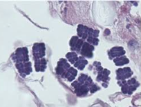 <p>What is this and what does it cause</p>