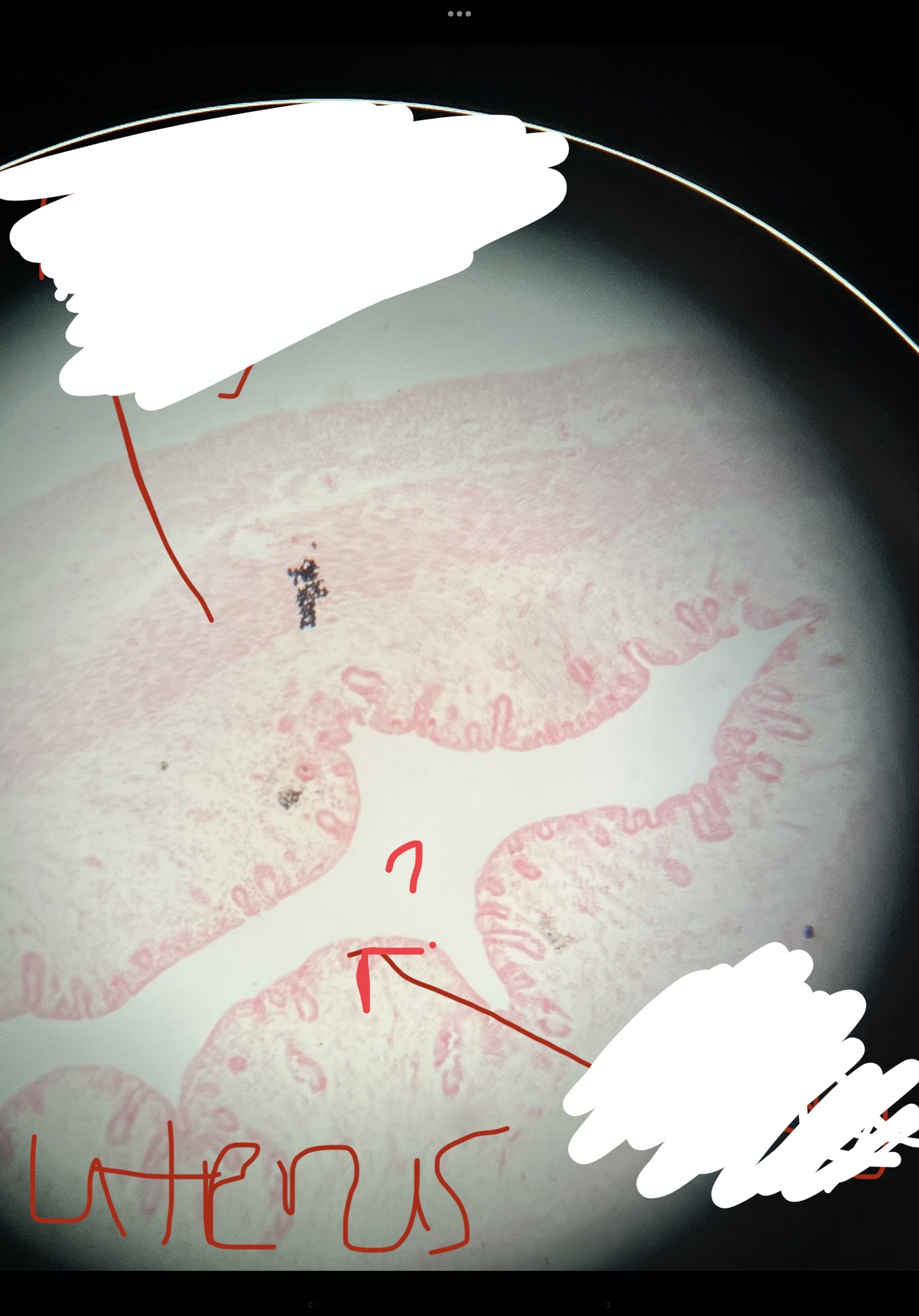 What is the arrow pointing to?