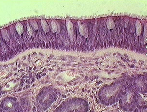 <p>Identify the type of epithelium, cilia, mucous cells, lamina propria, submucosa and serous glands.</p>