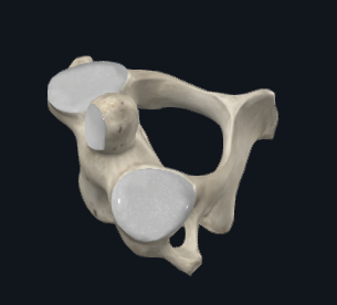 <p>What bone is this</p>