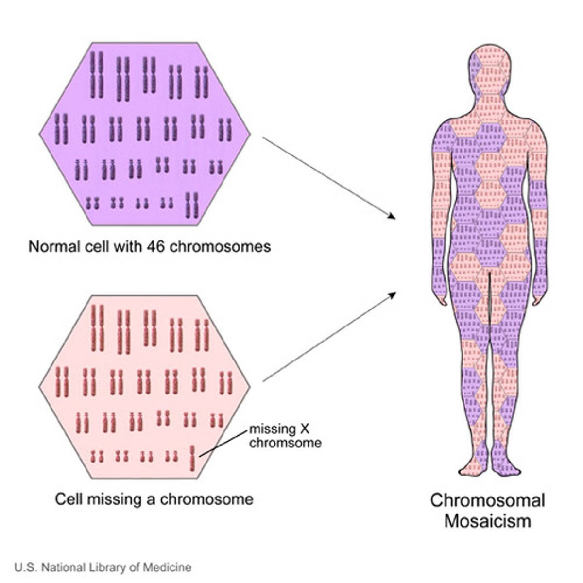 <p>2 or more karyotypes are consistently present in 1 person, with some normal and abnormal cells</p>