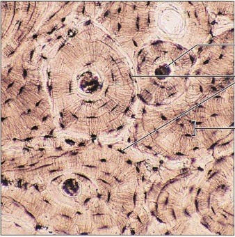 <p>bone supports and protects (by enclosing); provides levers for the muscles to act on; stores calcium and other minerals and fat; marrow inside bones is the site for blood cell formation (hematopoiesis)</p>