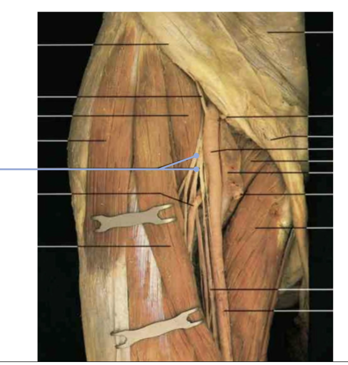 <p>Severing this nerve would result in motor loss to which of the following muscles?&nbsp;</p>