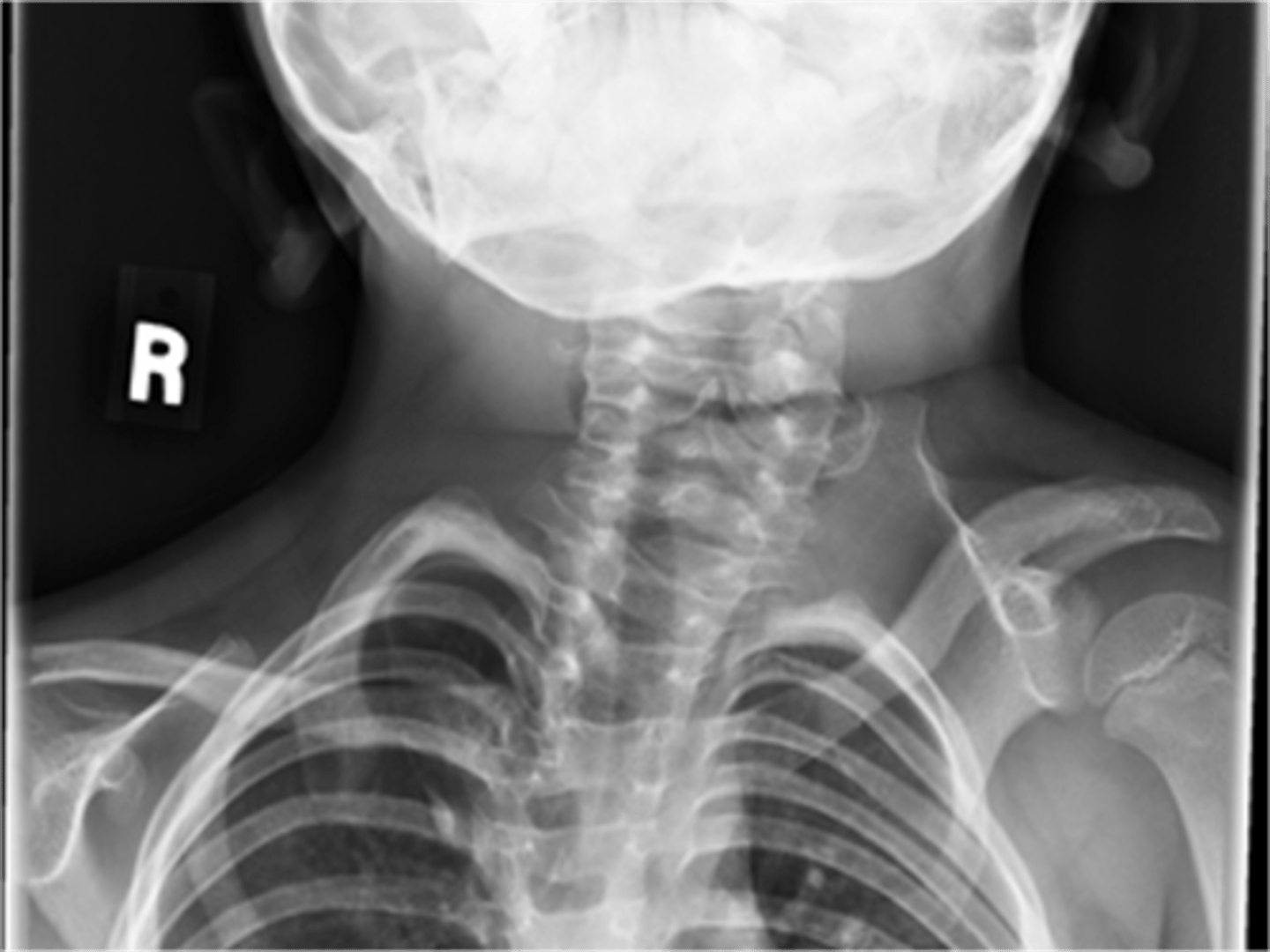 <p>State diagnosis</p>