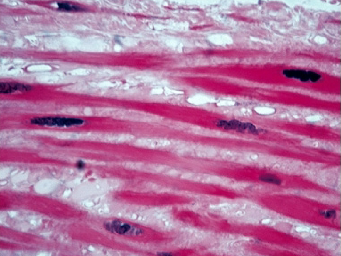 <p>What is the function of the smooth muscle tissue?</p>