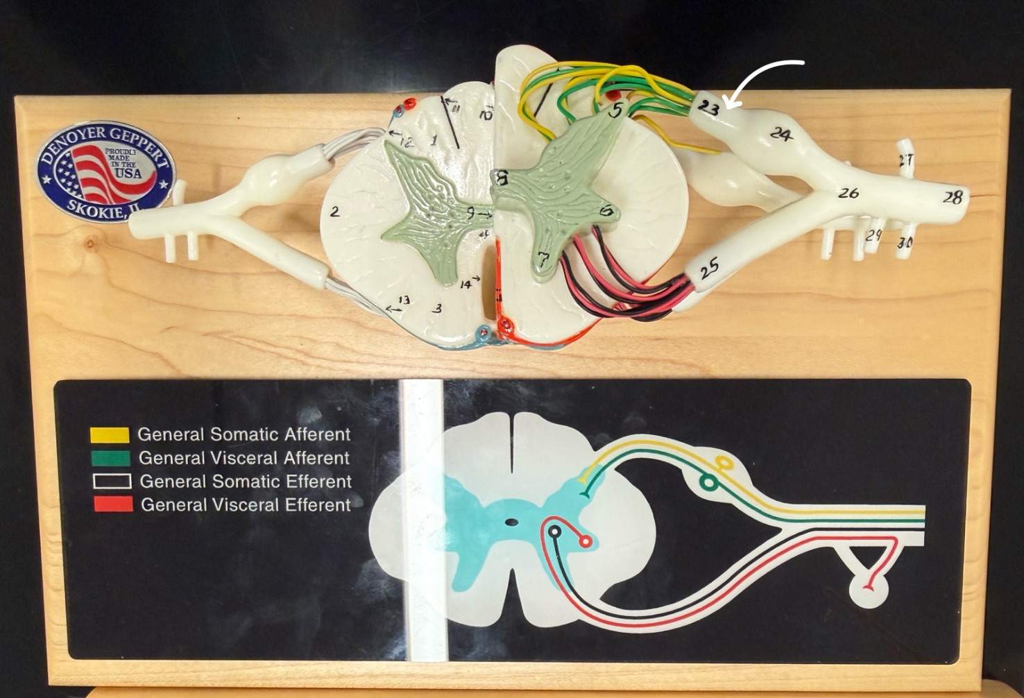<p>Name what is pointed at on the spinal cord model</p>
