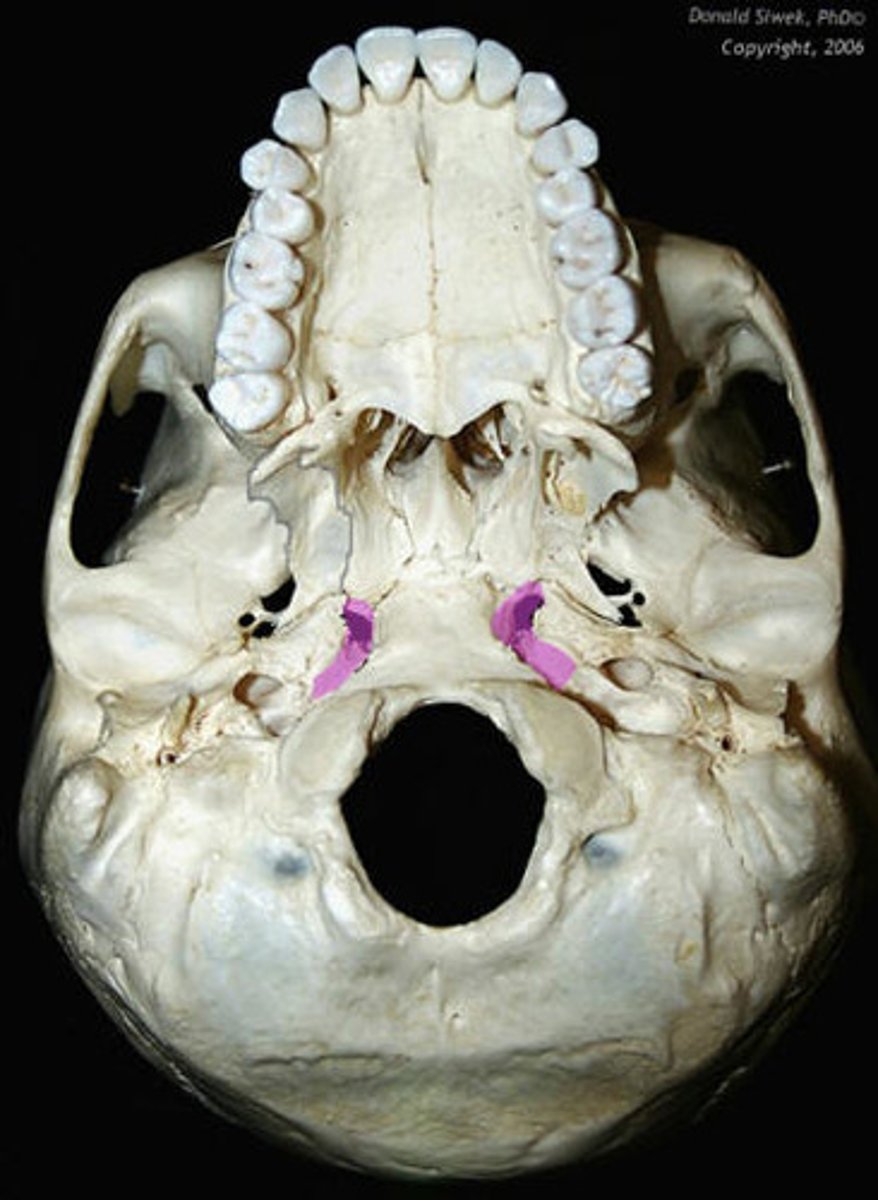 <p>leads to bony potrion of pharyngotympanic tube</p>