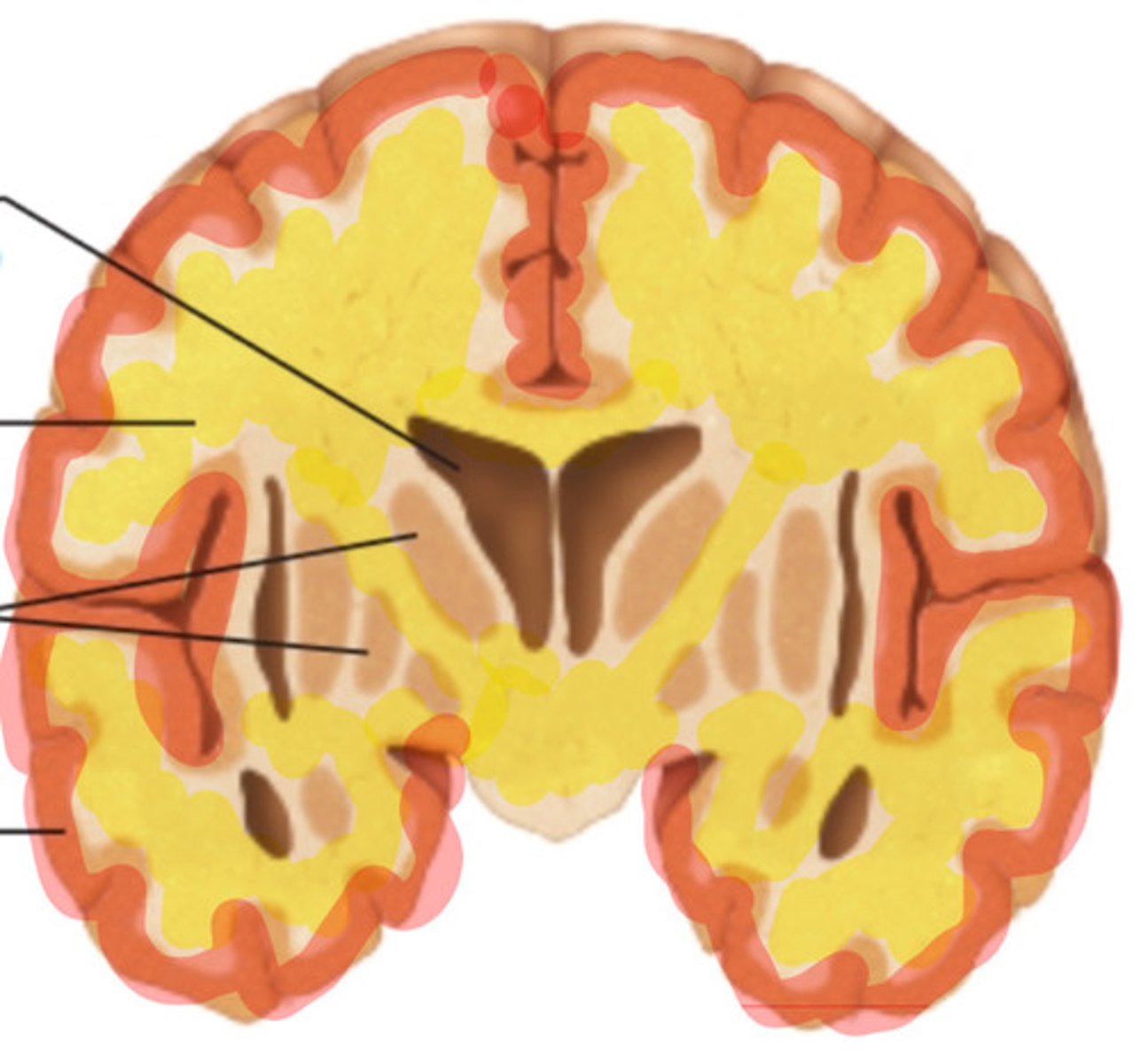 <p>what is highlighted in yellow?</p>