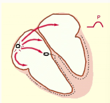 <ul><li><p>electrical impulse generated in the SA node</p></li><li><p>impulse is rapidly spread across the atrial muscle, causing depolarisation and contraction = atrial systole</p></li><li><p>impulse arrives at AV node</p></li></ul><p></p>