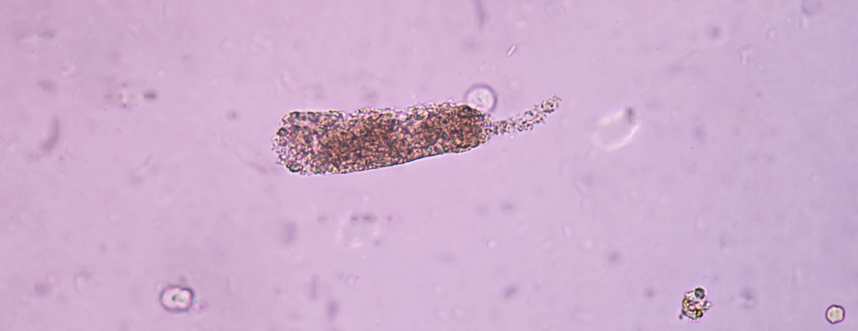 Granular casts