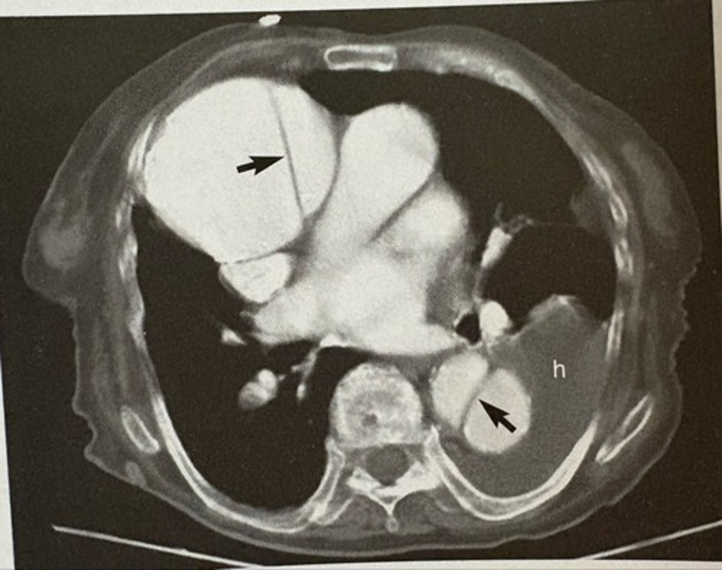 <p>what pathology is present?</p>
