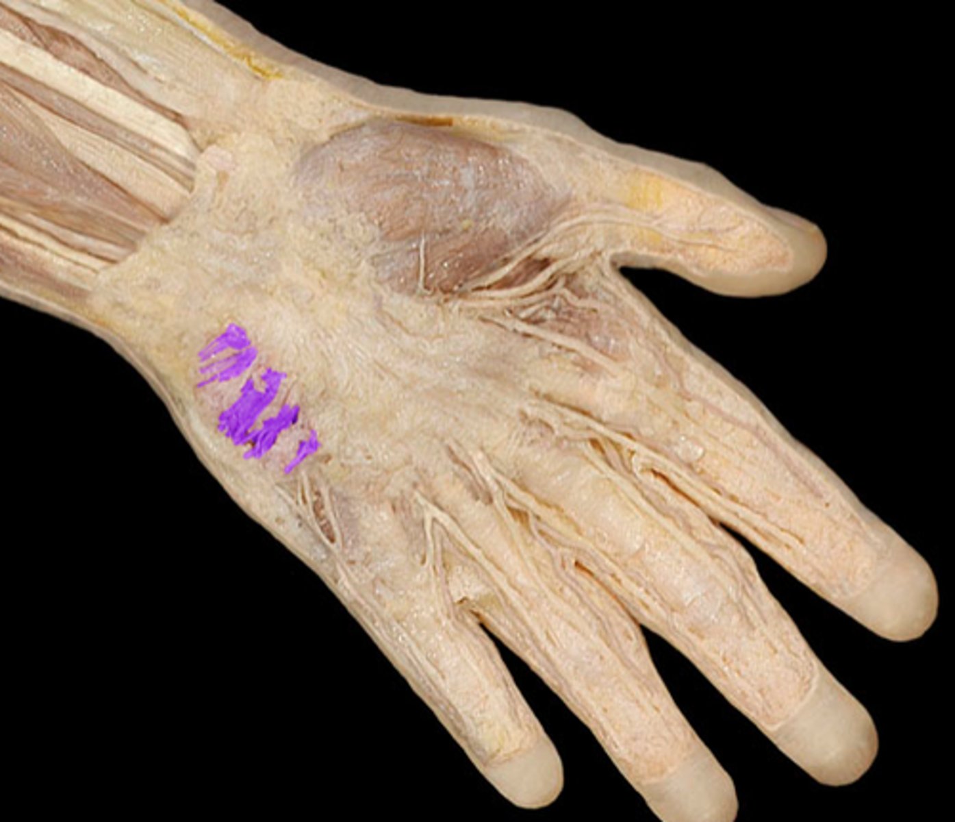 knowt flashcard image