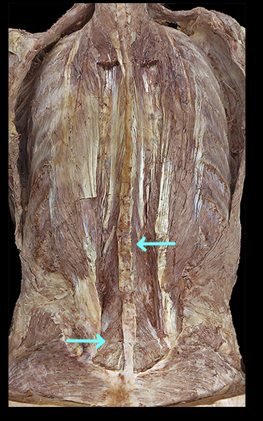 <p>Structure (part of <span>transversospinalis overall)</span></p>