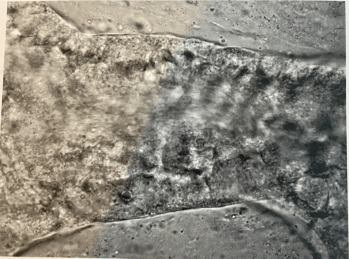 <p>The motion of cytoplasm in a cell that results in a coordinated movement of the cell's contents.</p>
