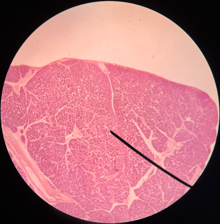 • The exocrine part of the pancreas.

• Composed of acinar cells.

• Secretes digestive enzymes.