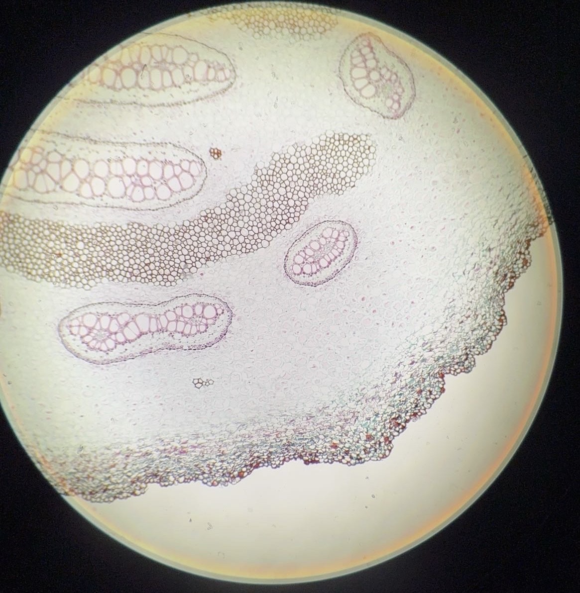 <p><span>What is this organism?</span></p>