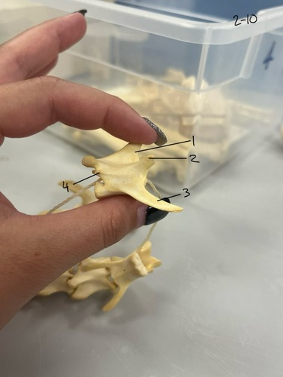 <p>Entire Structure?</p>