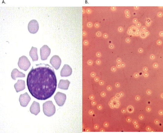 <p>protect against intracellular pathogens</p><p>help activate B-cells and macrophages</p><p>APC interactions </p><p>IL-2 and IFN-gamma secretion from T-helper cells </p><p>form rosettes when interacting with sheep RBCs</p>