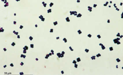 <p>What Gram staining property do the cells in the image have?</p>