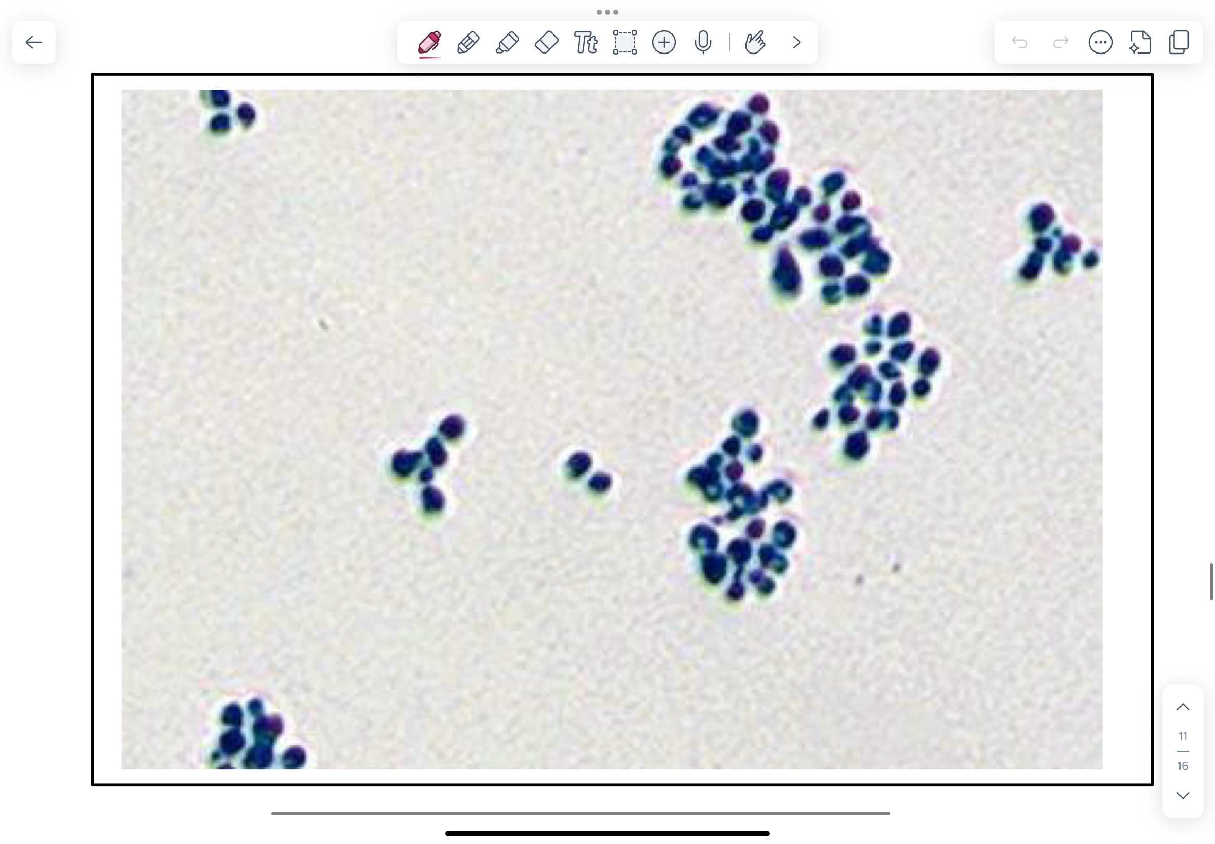 <p>Photomicrographs of LPCB-stained Histoplasma capsulatum prepared from colonies grown at 200C and 350C.</p>