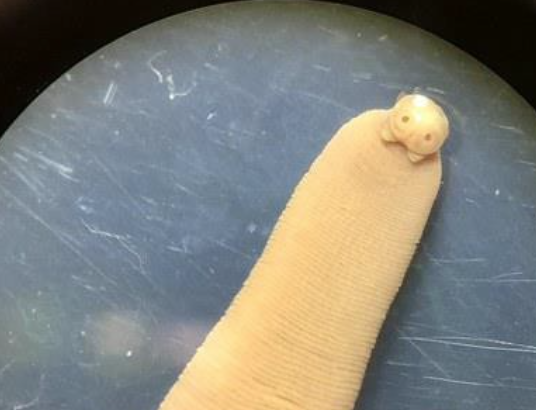 <p>Identify the parasite.</p>