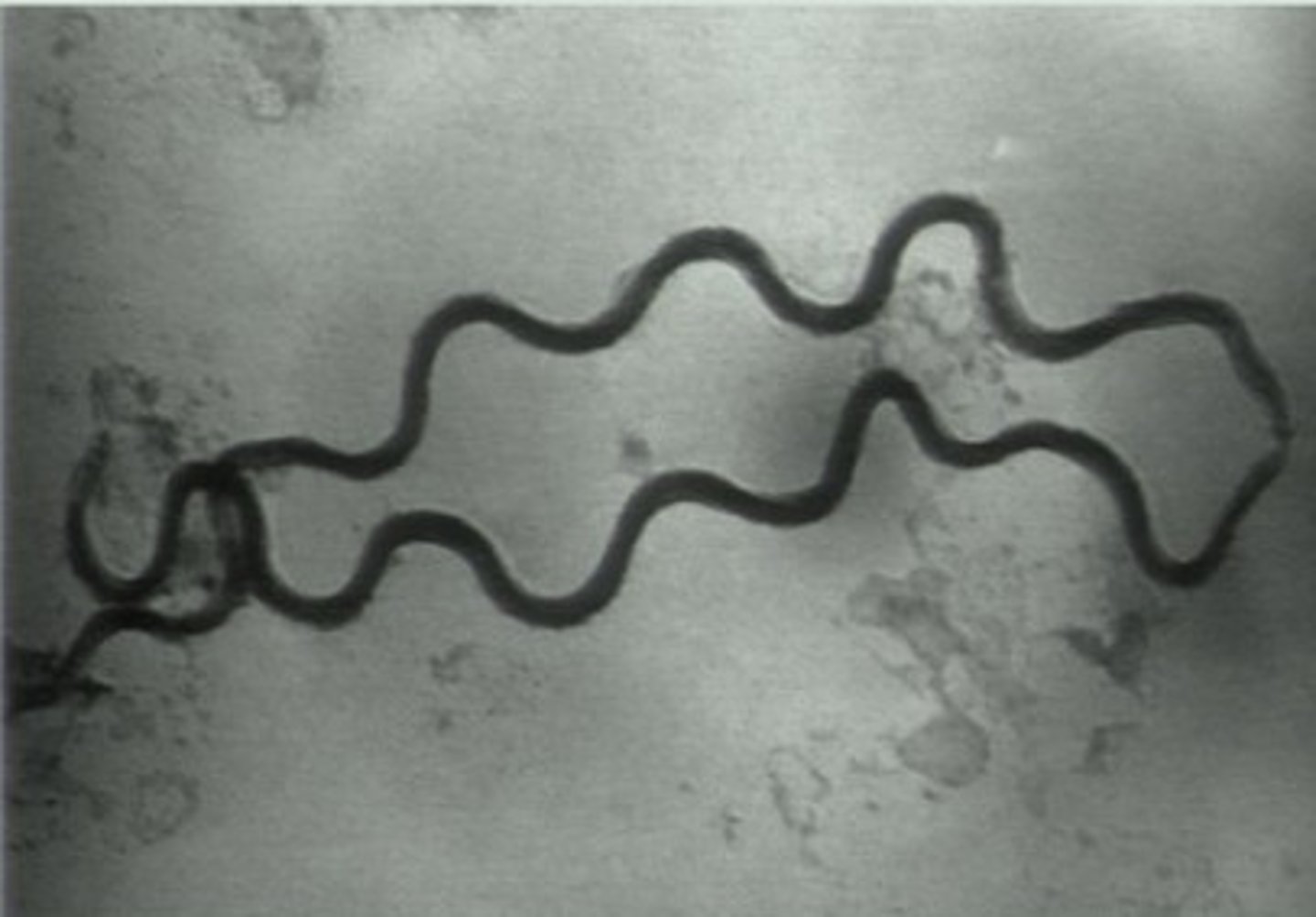 <p>syphillis</p><p>spirochaetes</p>