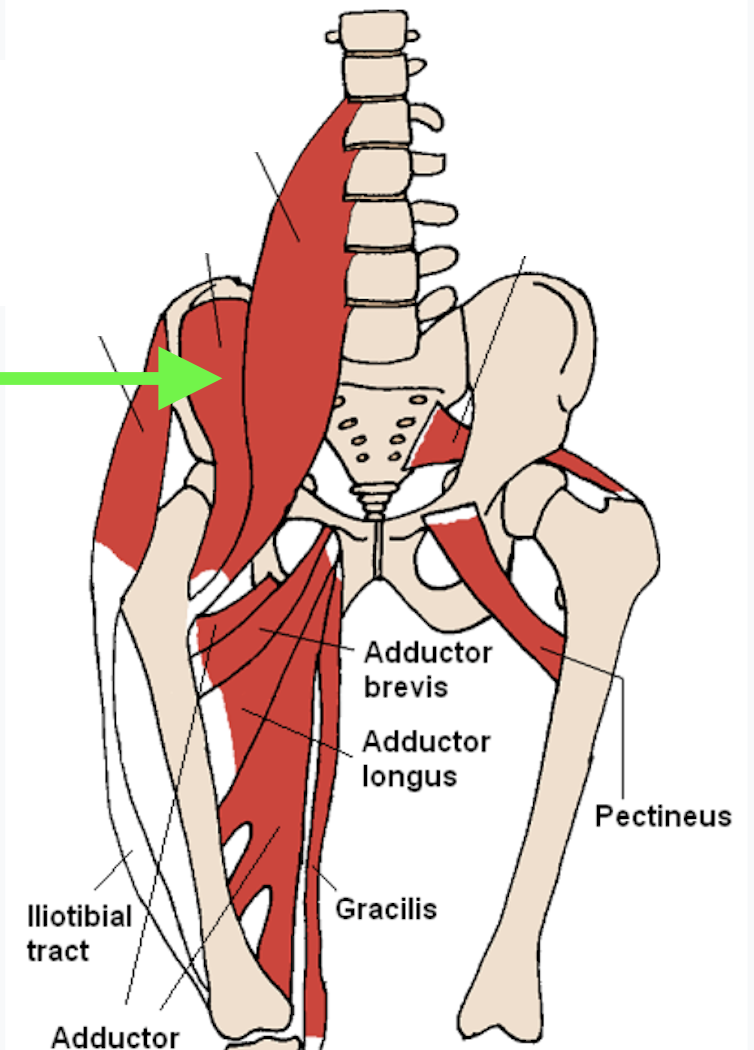 term image