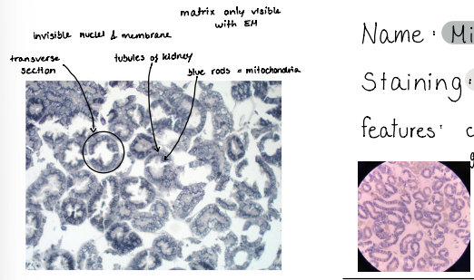 <p>Mitochondria</p><p>staining : iron-hematoxylin</p><p>features : cell divided into segments with back granules towards the outer membranes</p>
